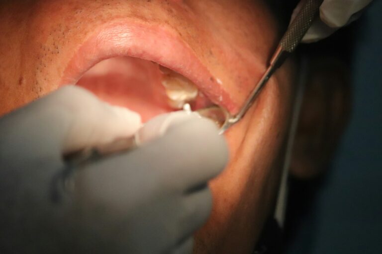 Dental floss close teeth dentist showing brushing technique